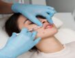 dermal fillers kuala lumpur