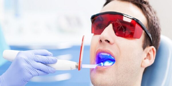 Laser Dentistry in Treating